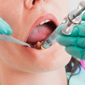 A anestesia odontológica é geralmente segura, mas é importante estar ciente dos riscos potenciais associados a esse procedimento.