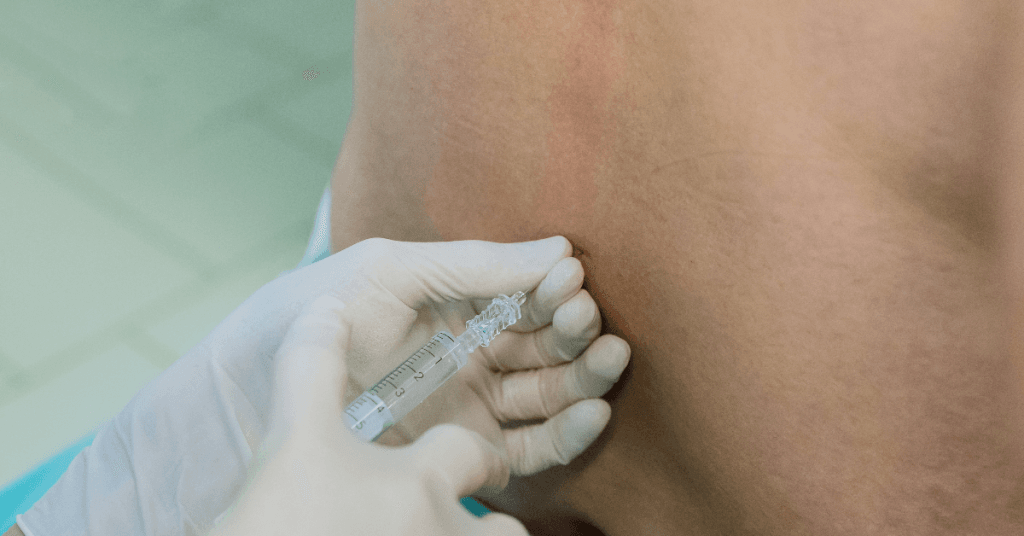 ): Saiba como prevenir, tratar e diagnosticar a cefaleia pós-raqui, uma possível complicação após procedimentos cirúrgicos com anestesia subdural ou raquidiana.
