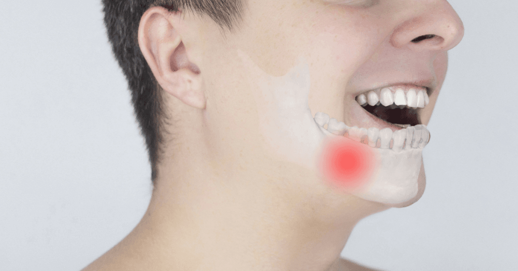 Descubra os medicamentos relacionados à osteonecrose e como prevenir essa condição