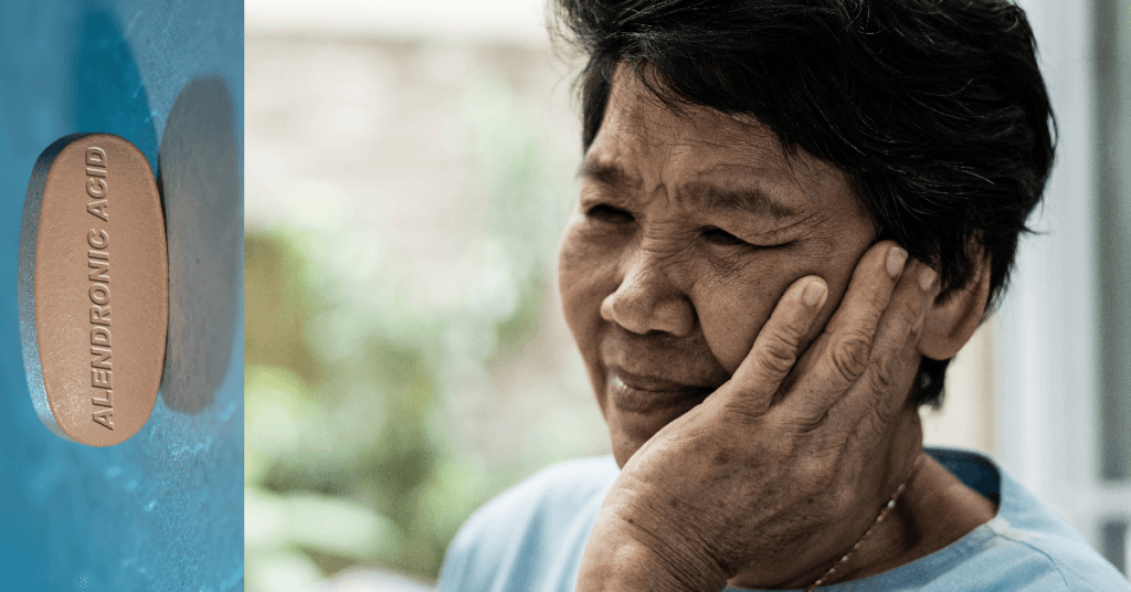 Saiba como lidar com a osteonecrose em pacientes que usam bisfosfonatos. Condutas para prevenir complicações graves. Dicas de segurança odontológica.