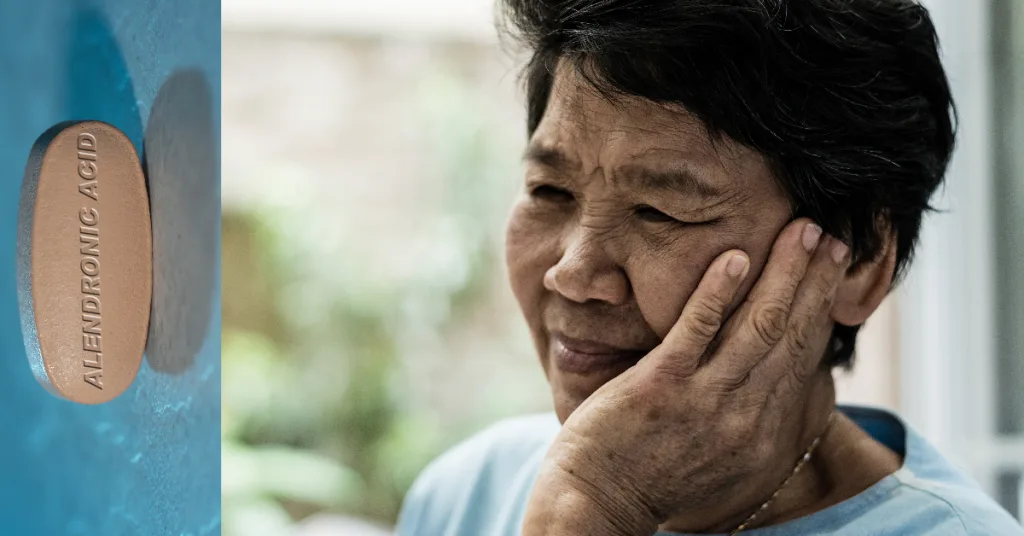 Saiba como lidar com a osteonecrose em pacientes que usam bisfosfonatos. Condutas para prevenir complicações graves. Dicas de segurança odontológica.