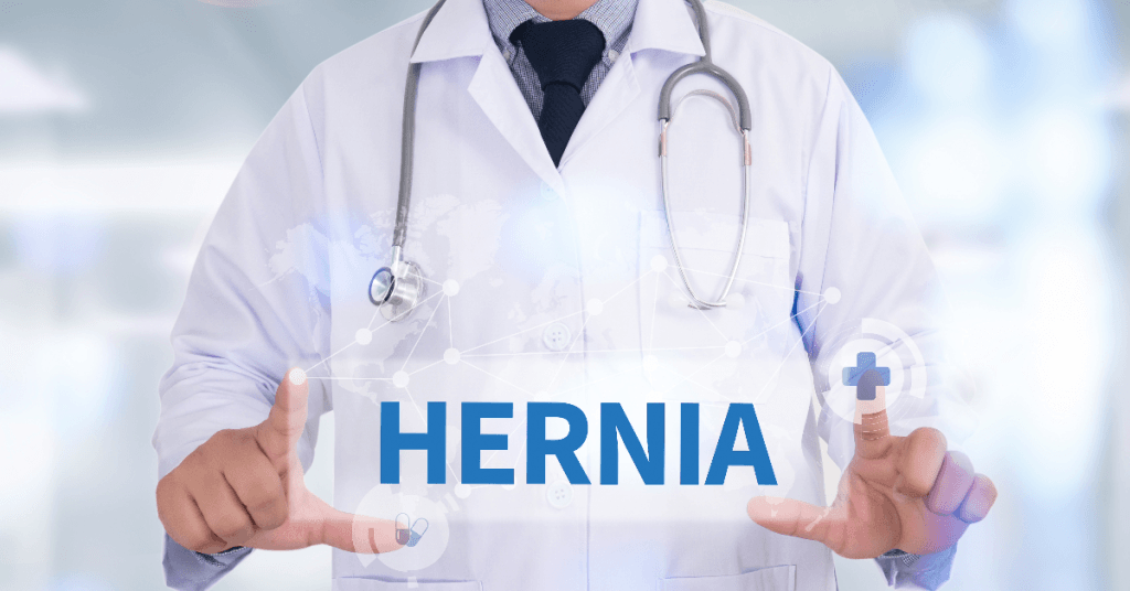 Descubra tudo sobre hérnias inguinais, incluindo causas, tipos e opções de tratamento. Saiba quando procurar ajuda médica.