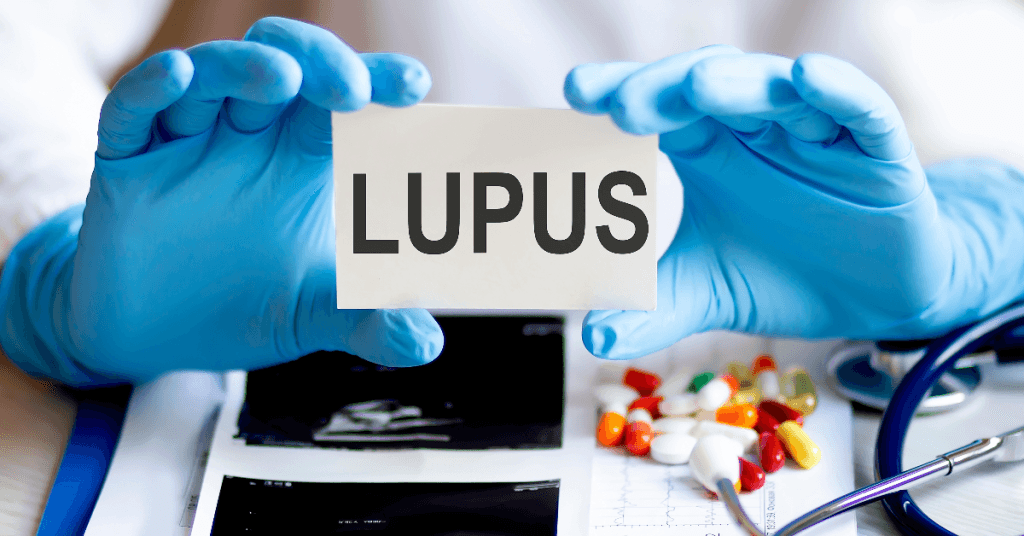 Descubra os riscos cirúrgicos e anestésicos em pacientes com lupus. Saiba como a anestesia afeta essa condição autoimune e como minimizar complicações.