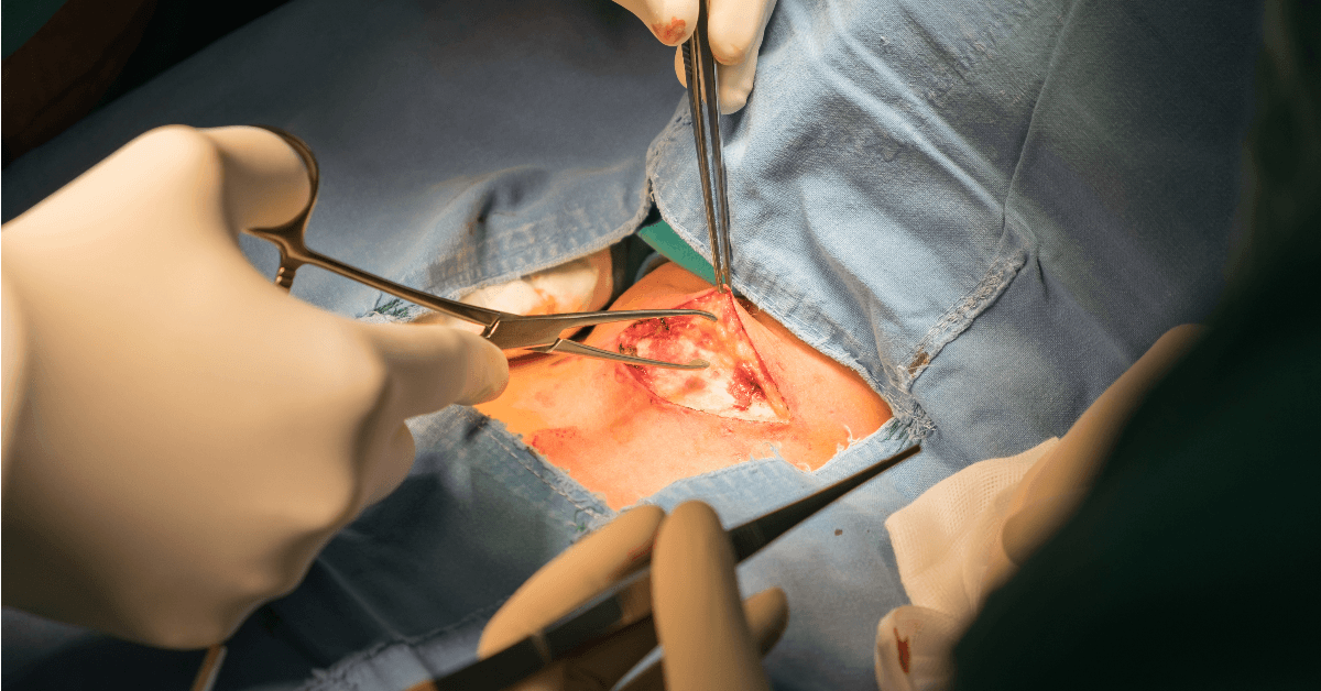 Entenda a relação entre anestesia e hipotireoidismo, seus riscos, e como se preparar para uma cirurgia com segurança. Saiba mais!