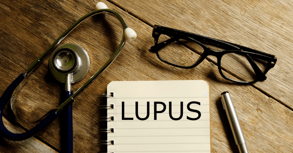 Descubra o que é o lupus, seus tipos, sintomas e como é feito o diagnóstico. Entenda as doenças autoimunes e seus desafios.