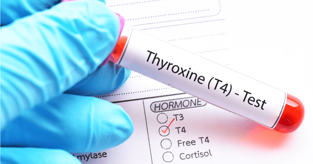 Meta-descrição: O que é hipotireoidismo secundário? Descubra suas causas, epidemiologia, fisiopatologia e como prevenir. Um guia completo sobre essa condição da tireoide. Saiba mais.
