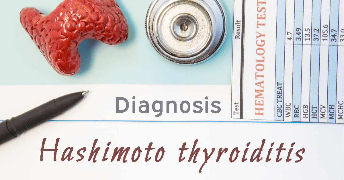 Tireoidite De Hashimoto: Causas, Sintomas, E Tratamento - Dr. Ivan Vargas