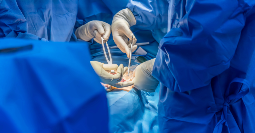 Explore as opções de anestesia para cirurgia de hérnia umbilical: local, raqui e geral. Saiba qual é mais segura para sua saúde e recuperação.