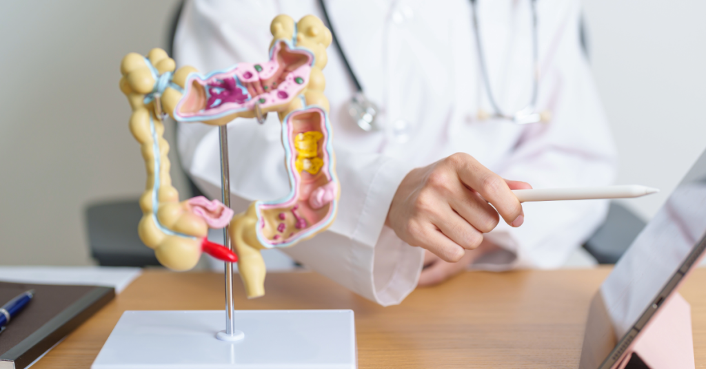 Saiba quais medicamentos evitar na colite ulcerativa para prevenir surtos e complicações. Cuidados essenciais para o manejo da doença.