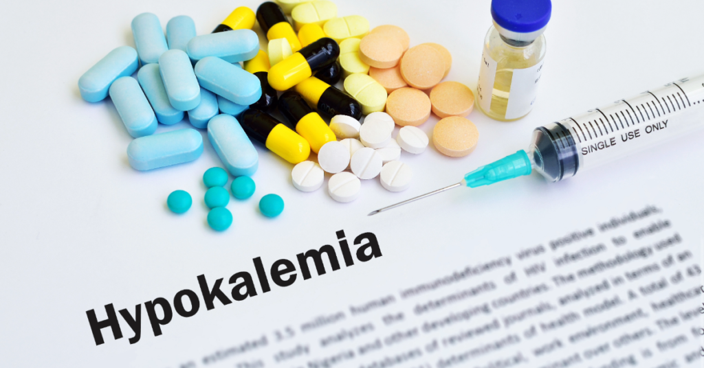 Descubra como medicamentos como diuréticos e beta-agonistas podem causar hipopotassemia e os cuidados necessários para evitá-la.