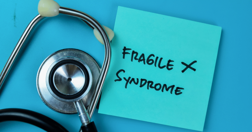 Saiba como manejar a anestesia em pacientes com Síndrome do X Frágil, ajustando sedação e evitando agitação ou efeitos adversos.